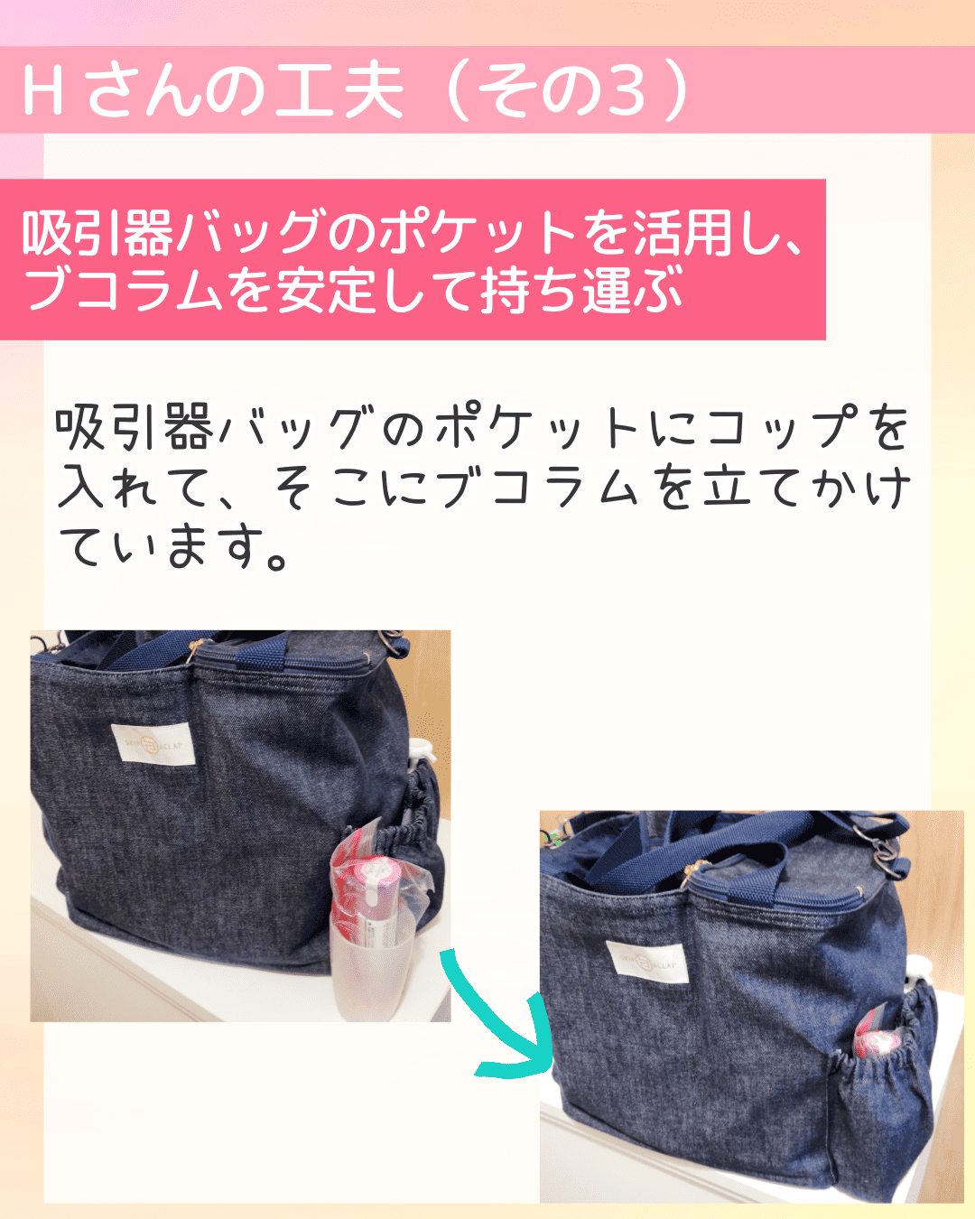 吸引器バッグのポケットを活用し、ブコラムを安定して持ち運ぶ 吸引器バッグのポケットにコップを入れて、そこにブコラムを立てかけています。